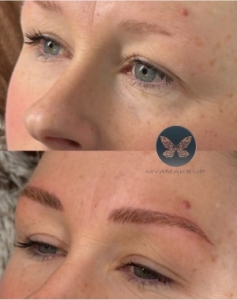 Microblading is an under rated treatment.